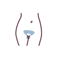 Bikini deep — front view, treated area in blue