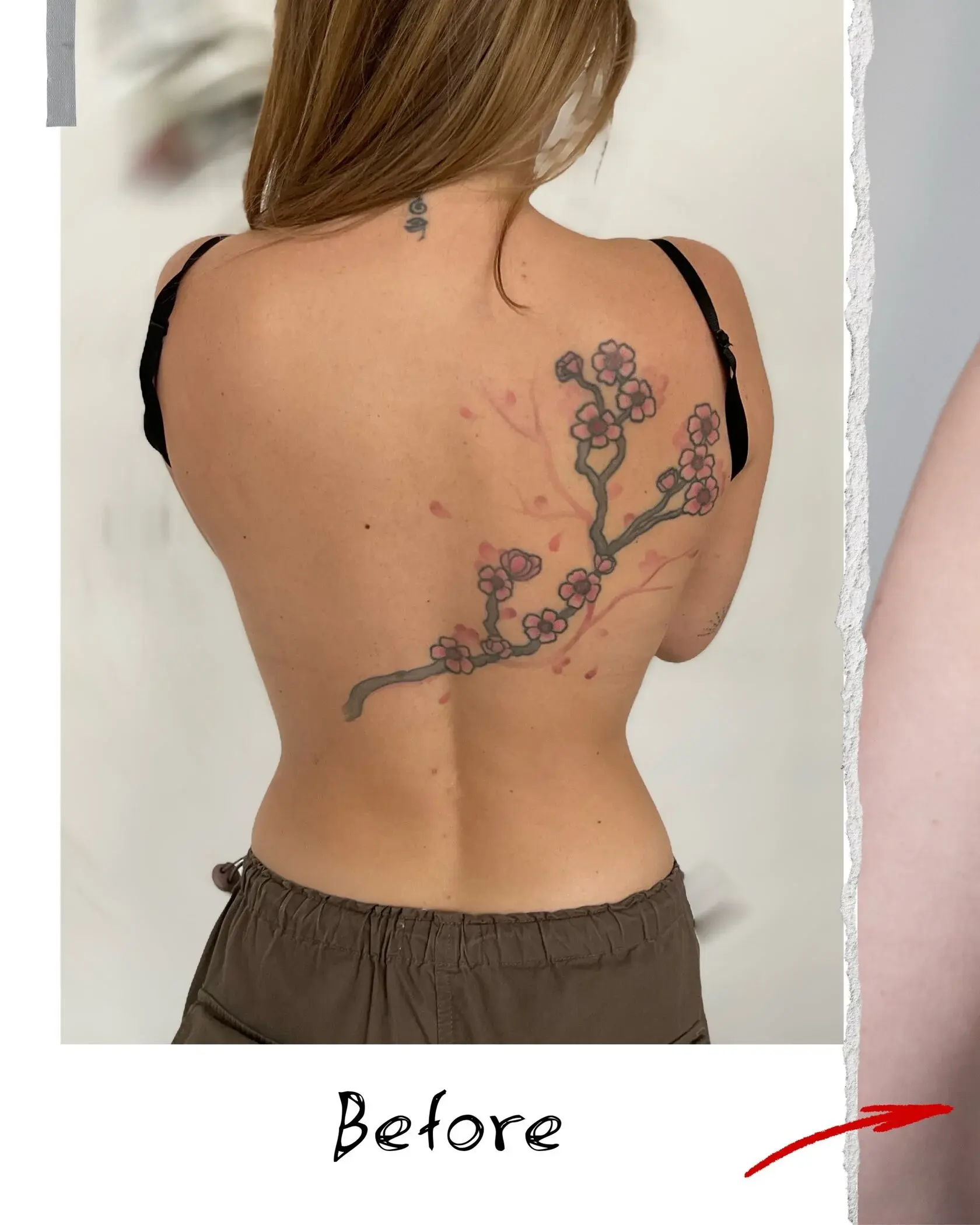 Cover Up Tattoo Beispiel 1 - Brennnessel Tattoo Berlin