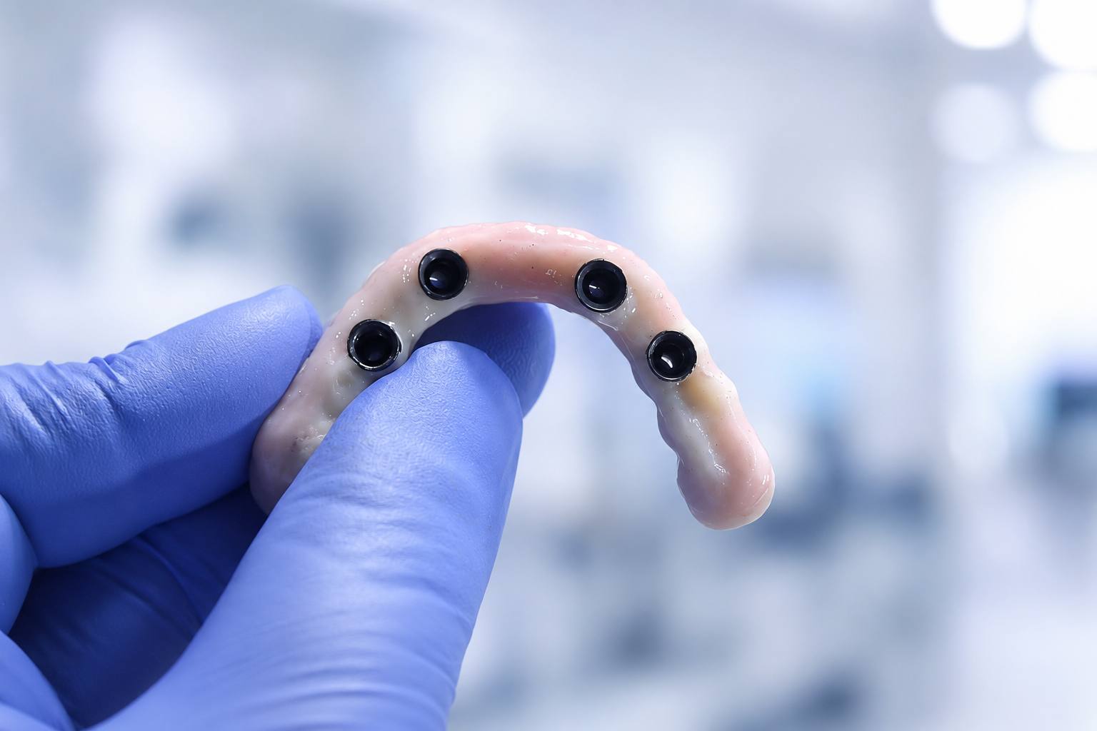Dental Implant