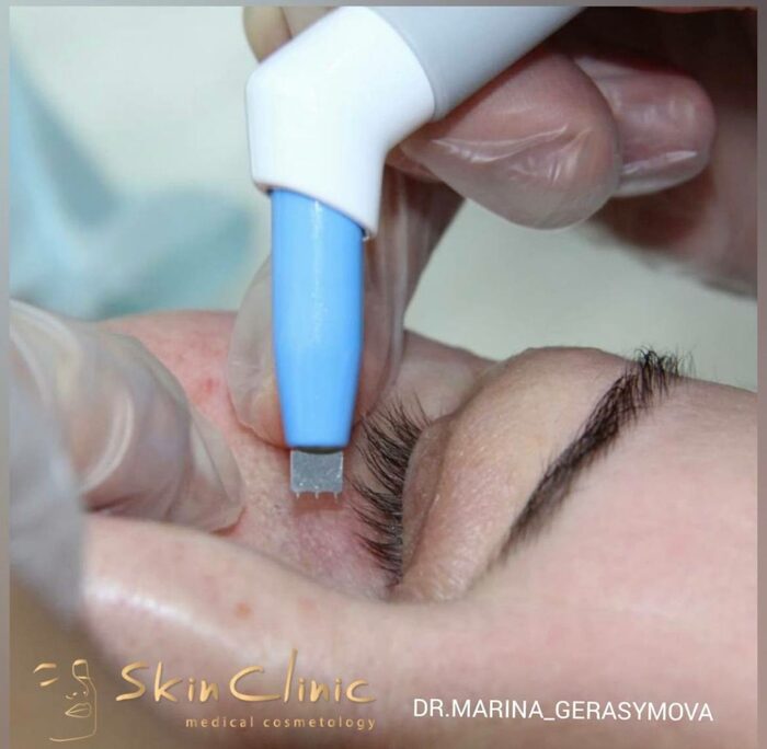 Обладнання та процедури SkinClinic: Agnes