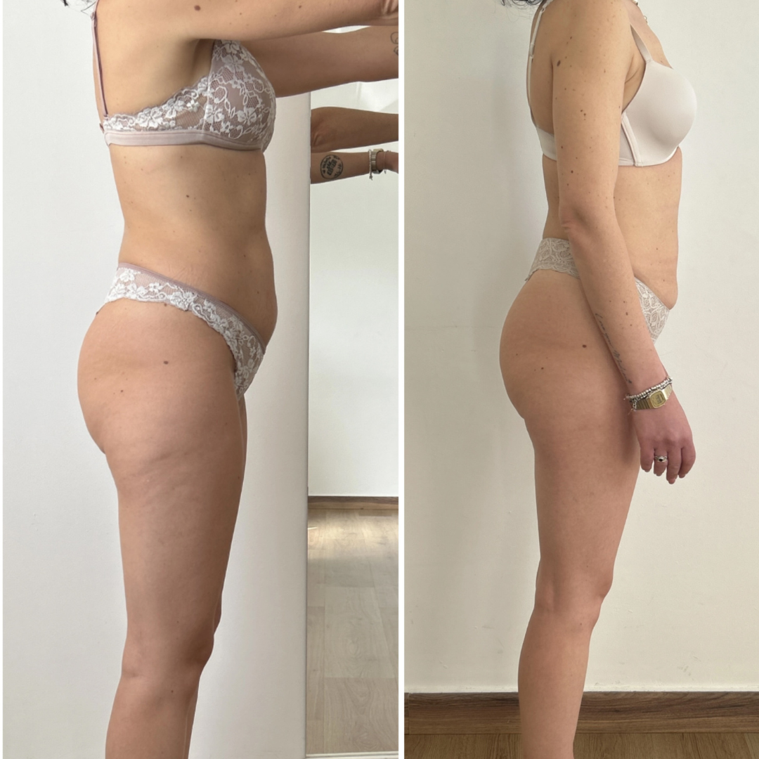 Trasformazione cliente ABT Fitness Boutique