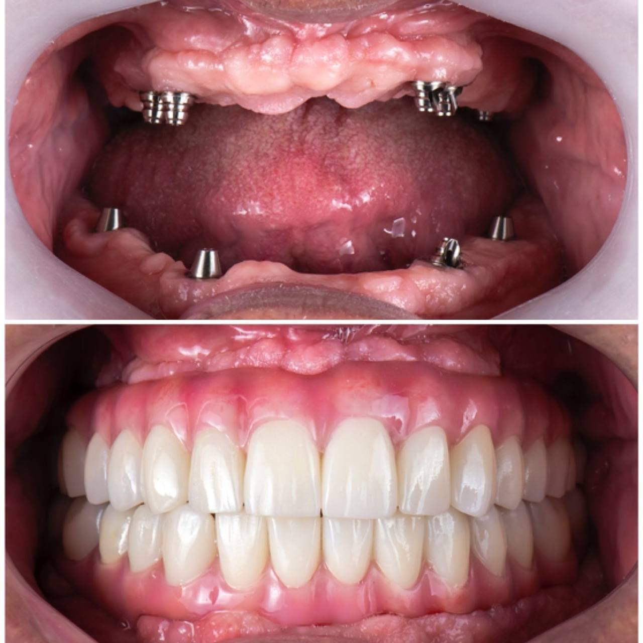 Dental smile transformation patient results