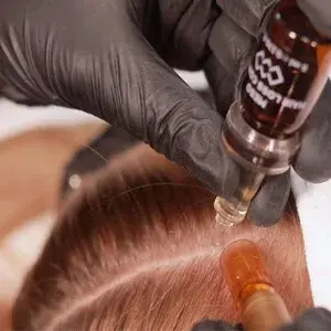 Fiala di prodotto applicata sulla riga dei capelli