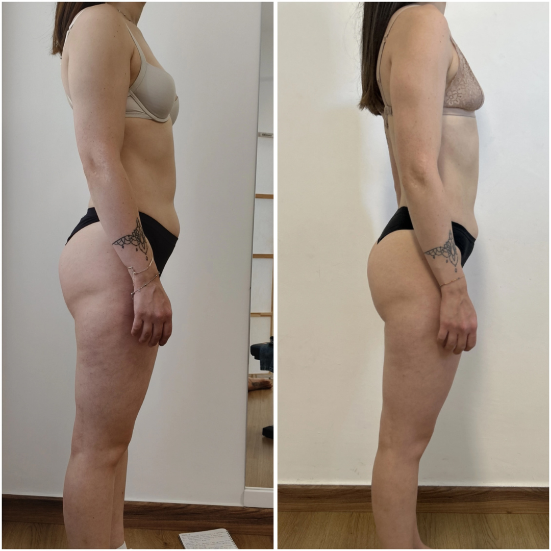 Trasformazione cliente ABT Fitness Boutique