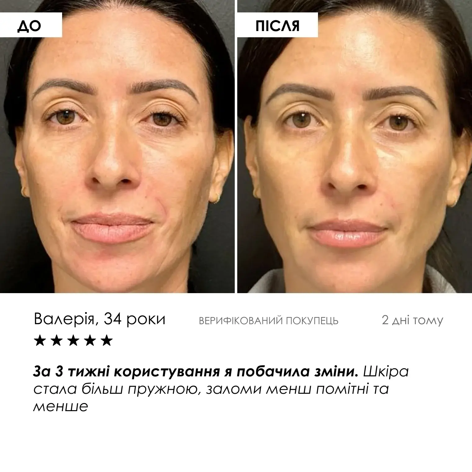 Набір нічного догляду з ретинолом ROBEAUTY