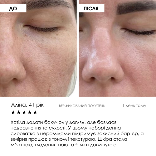 Набір сироваток «День + Ніч» ROBEAUTY — фото 8