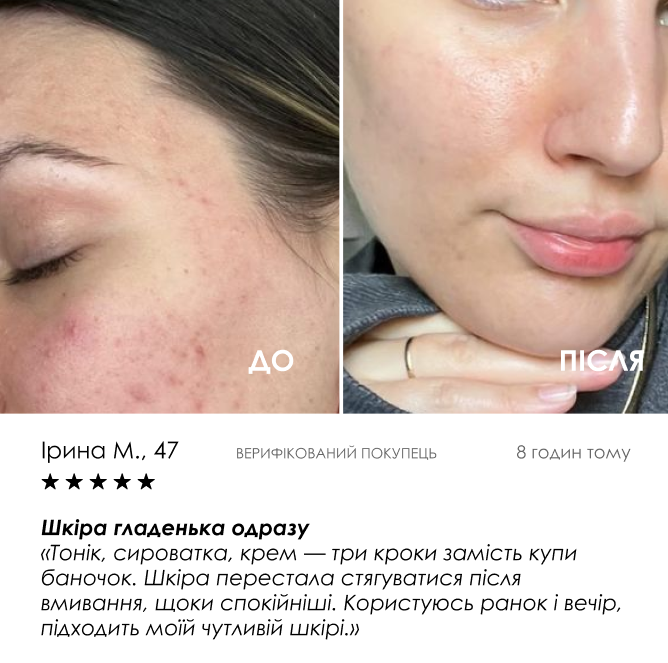 Набір «бар'єр» — фото 6