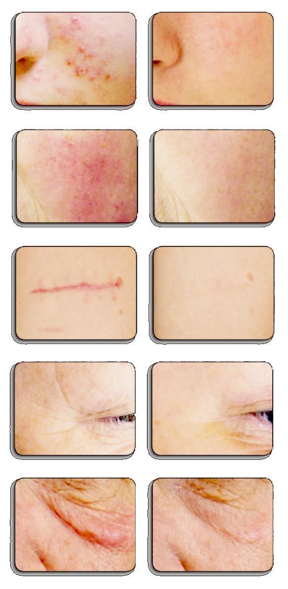 Komplexné výsledky