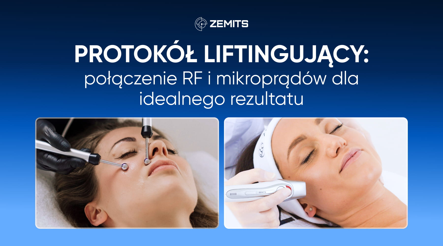 Zemits — ilustracja do artykułu