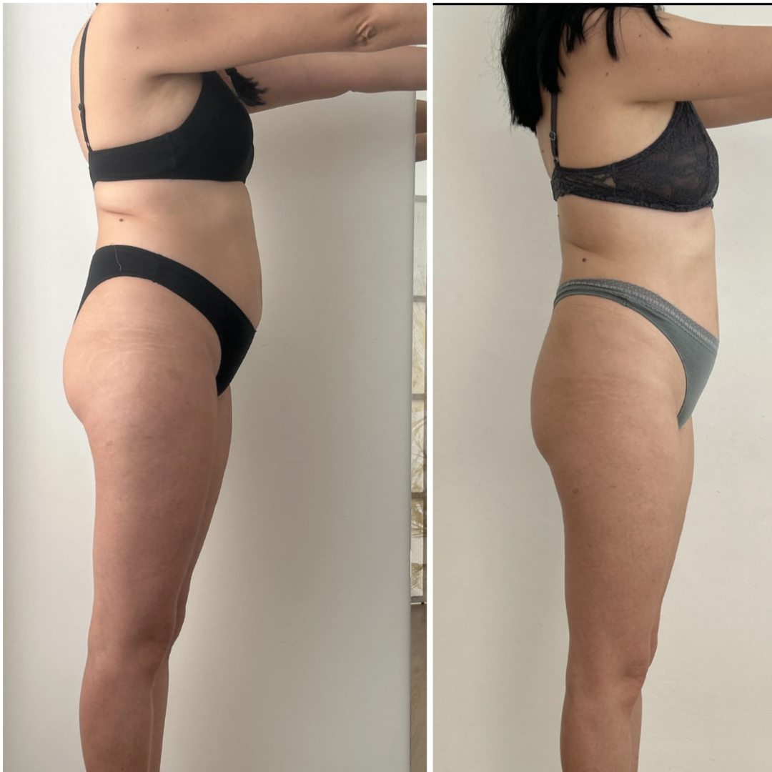 Trasformazione cliente ABT Fitness Boutique