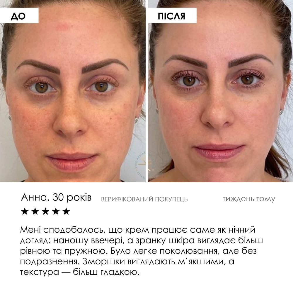 Максимальний ефект курсу — Night Retinol Cream