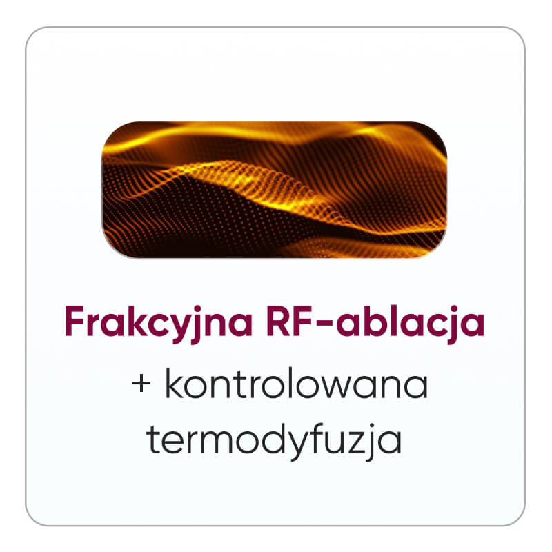 Zemits — ilustracja do artykułu