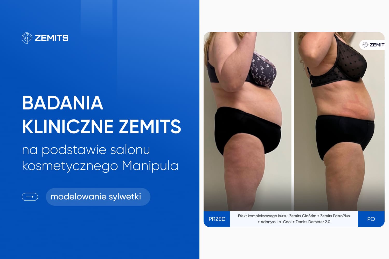 Zemits — ilustracja do artykułu