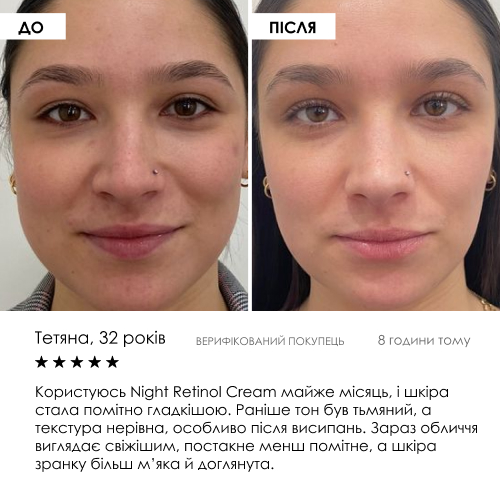 Liposomal Vitamin C Serum ROBEAUTY 30 мл — фото 6 з 9