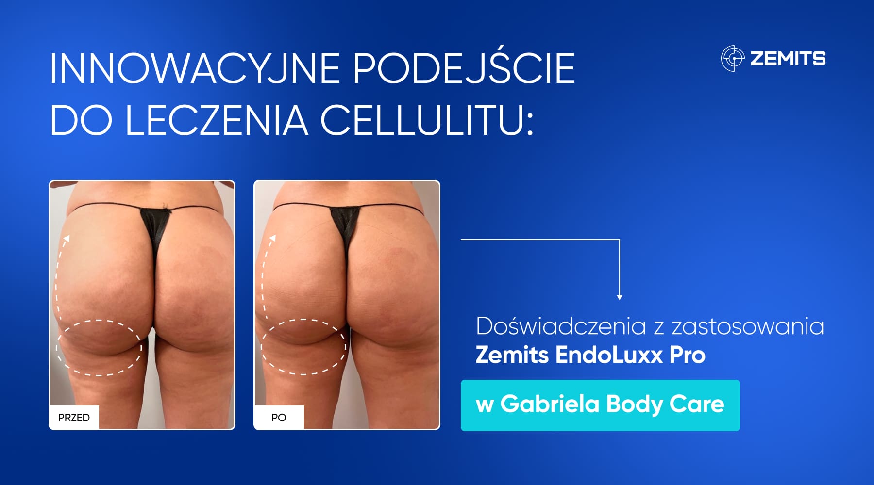 Zemits — ilustracja do artykułu