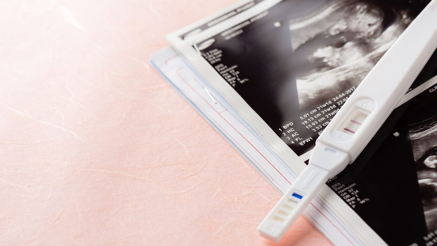 What to Expect at an IVF Center In Dubai