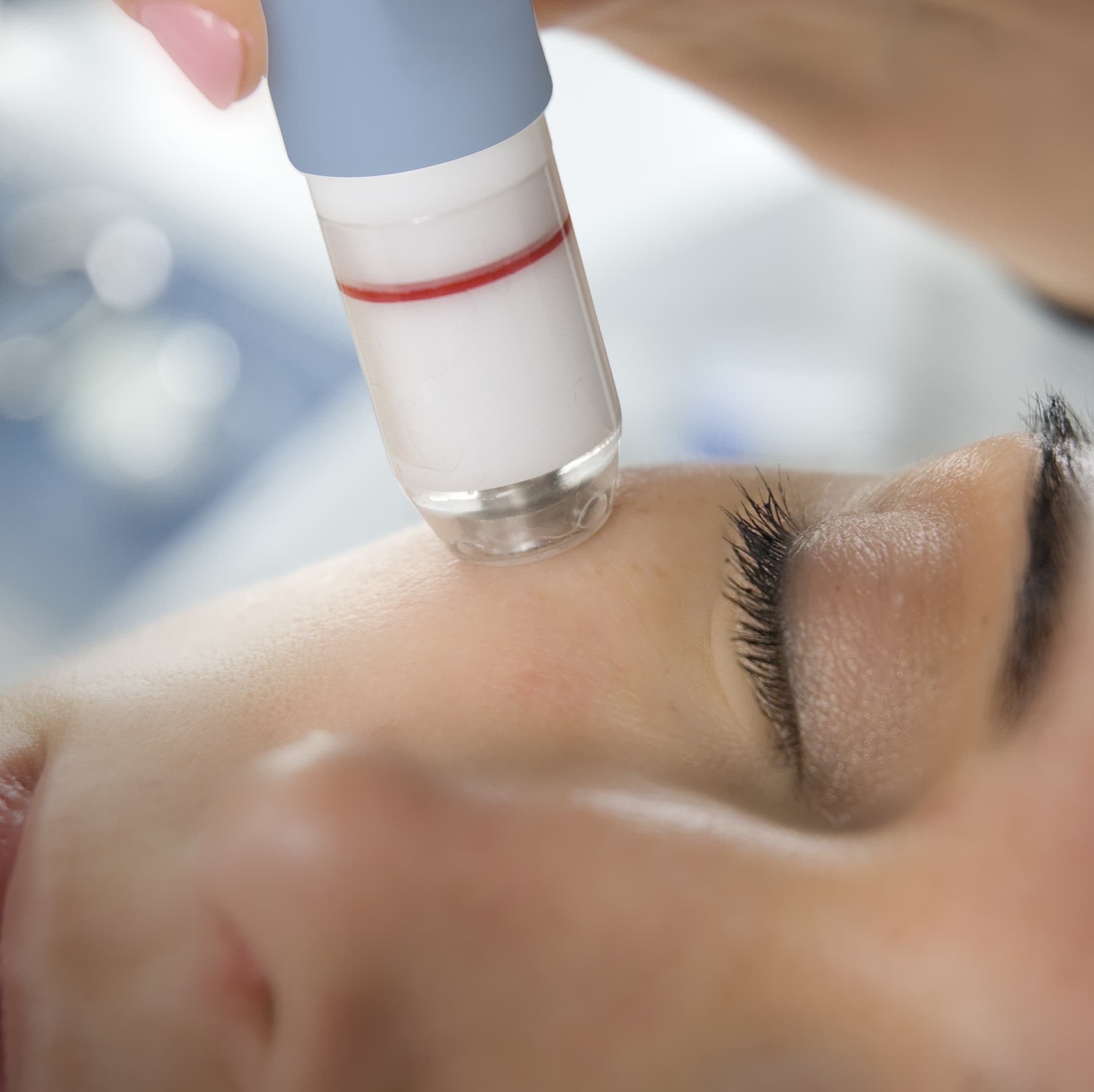 Biobrasion Facial treatment in Burbank at NewSkinLA skincare studio