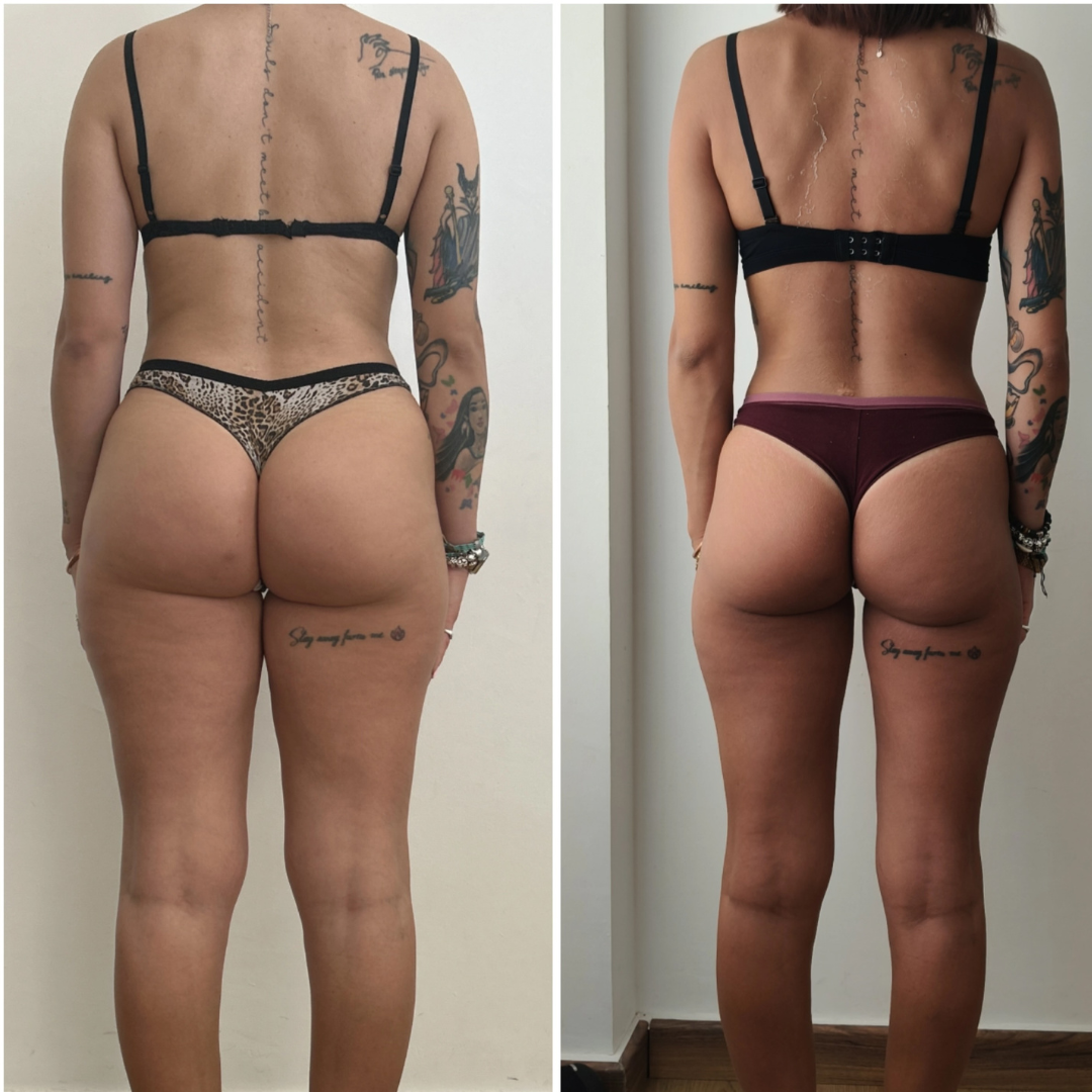 Trasformazione cliente ABT Fitness Boutique