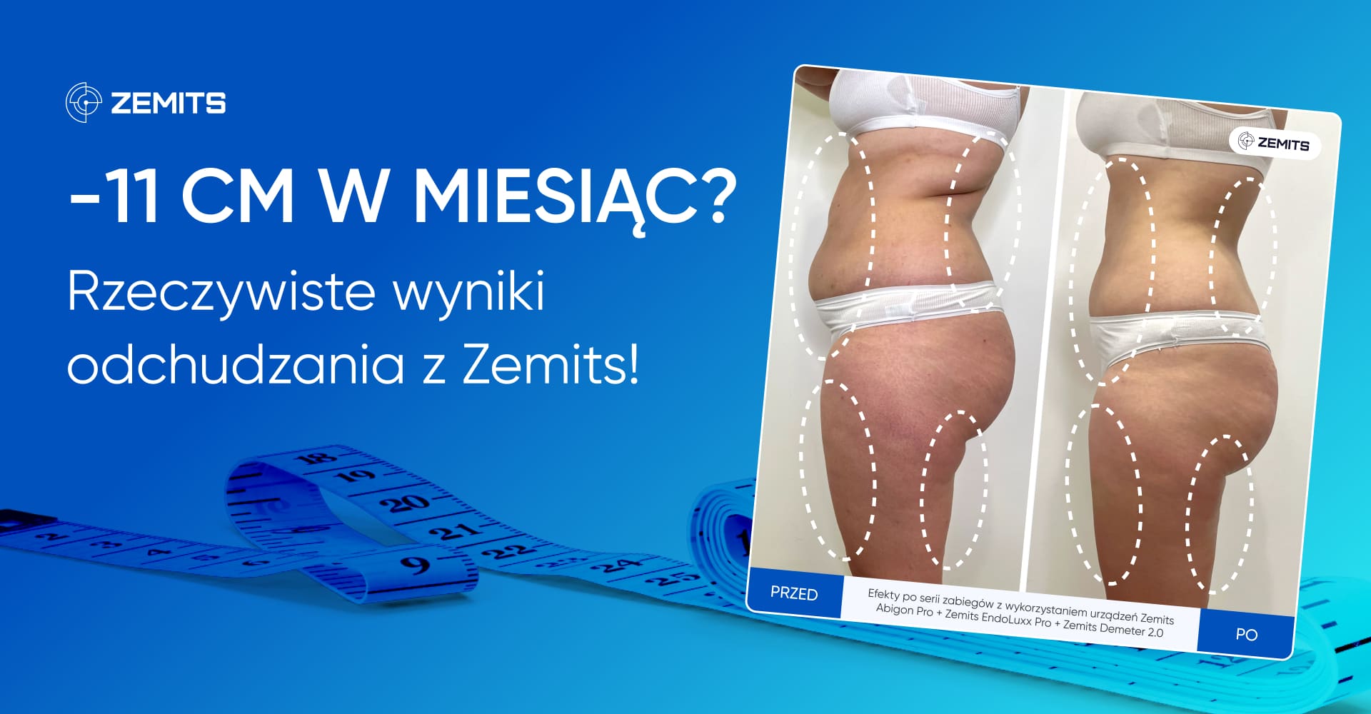 Zemits — ilustracja do artykułu