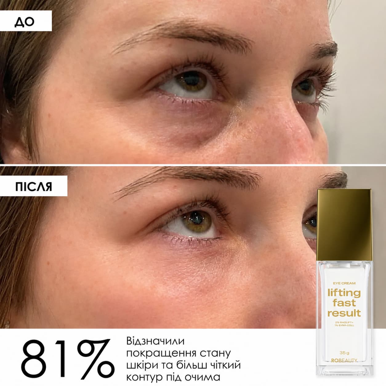 Крем для підтяжки нижньої повіки Lifting Fast Result Eye Cream