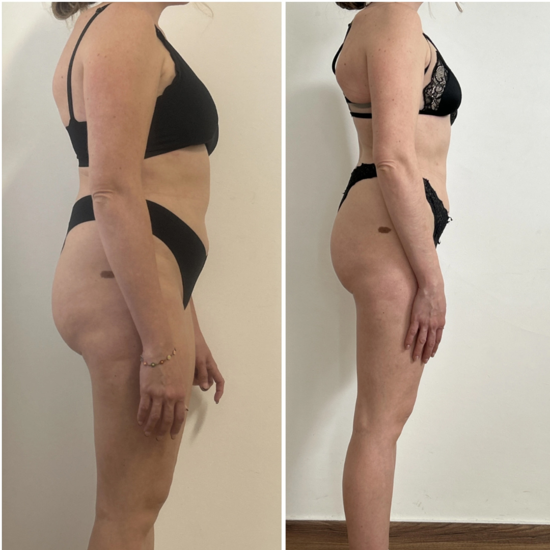 Trasformazione cliente ABT Fitness Boutique