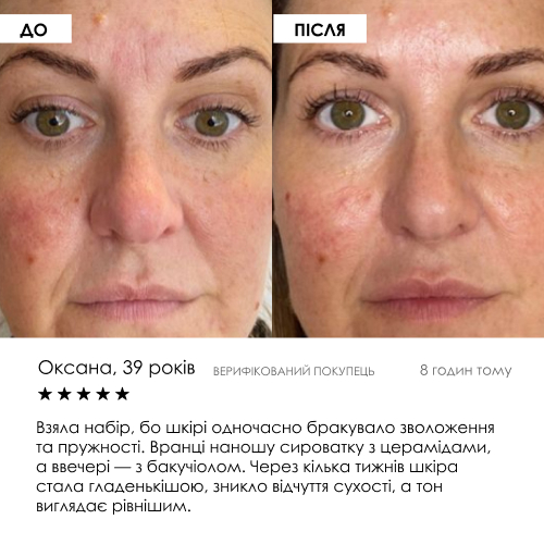 Набір сироваток «День + Ніч» ROBEAUTY — фото 6