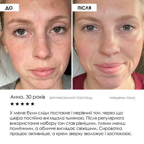 Набір сироватка та крем з ліпосомальним вітаміном C ROBEAUTY — фото 7 з 9